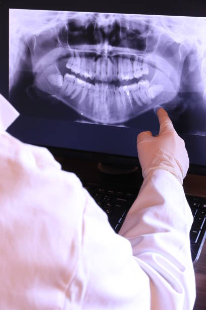 Best Emergency Treatment for Dental Infections or Abscesses in Milaca, MN
