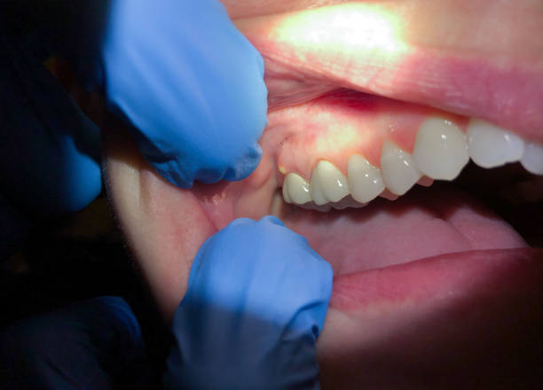 Best Emergency TMJ Treatment in Milaca, MN